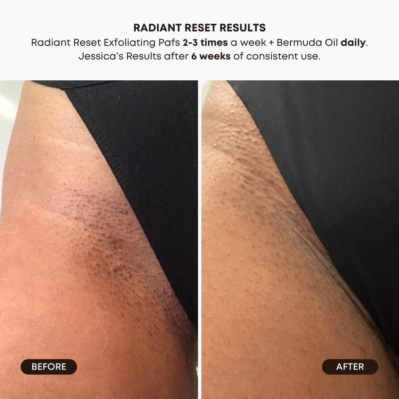 Disques Tonifiants Exfoliants Éclat Parfait