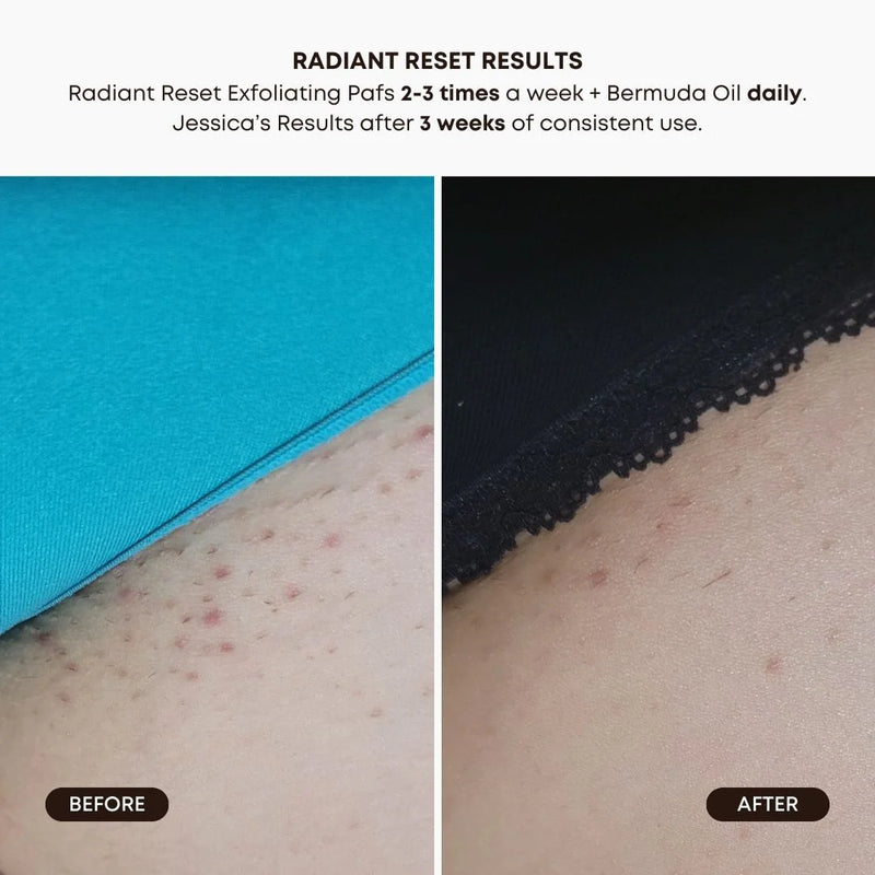 Disques Tonifiants Exfoliants Éclat Parfait
